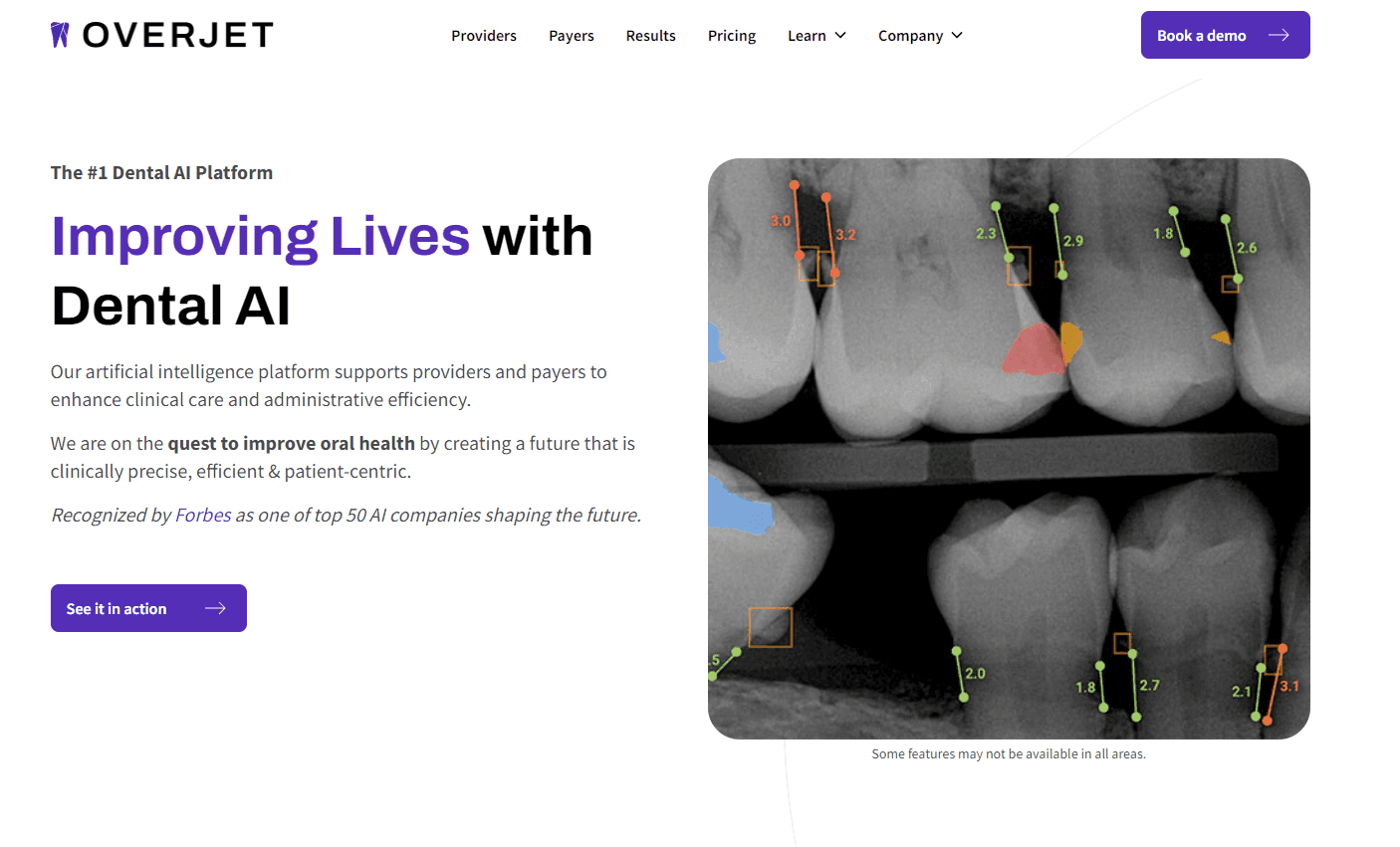 Overjet - Leading Dental AI Platform